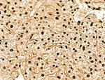 NR1 Antibody in Immunohistochemistry (Paraffin) (IHC (P))