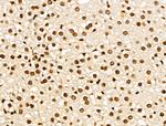 NR1 Antibody in Immunohistochemistry (Paraffin) (IHC (P))