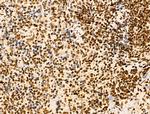 NR1 Antibody in Immunohistochemistry (Paraffin) (IHC (P))