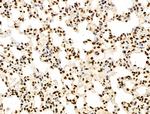 NR1 Antibody in Immunohistochemistry (Paraffin) (IHC (P))