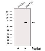 NR1 Antibody in Western Blot (WB)