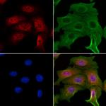 NME5 Antibody in Immunocytochemistry (ICC/IF)