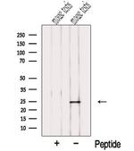 NME5 Antibody in Western Blot (WB)