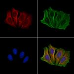 NOXA Antibody in Immunocytochemistry (ICC/IF)