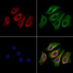 NUDT9 Antibody in Immunocytochemistry (ICC/IF)