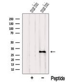 NUS1 Antibody in Western Blot (WB)