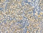 OBFC2B Antibody in Immunohistochemistry (Paraffin) (IHC (P))