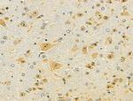 OCIAD1 Antibody in Immunohistochemistry (Paraffin) (IHC (P))