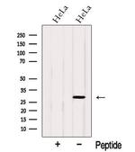 OCIAD1 Antibody in Western Blot (WB)