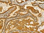 TENM1 Antibody in Immunohistochemistry (Paraffin) (IHC (P))