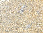 OGDHL Antibody in Immunohistochemistry (Paraffin) (IHC (P))