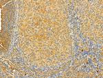 OGDHL Antibody in Immunohistochemistry (Paraffin) (IHC (P))