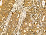 OGDHL Antibody in Immunohistochemistry (Paraffin) (IHC (P))