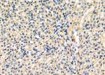 GNA13 Antibody in Immunohistochemistry (Paraffin) (IHC (P))