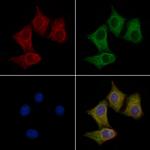 UCP4 Antibody in Immunocytochemistry (ICC/IF)