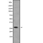 UCP4 Antibody in Western Blot (WB)