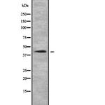 NDUFA10 Antibody in Western Blot (WB)