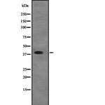 eIF2b beta Antibody in Western Blot (WB)