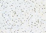 APR3 Antibody in Immunohistochemistry (Paraffin) (IHC (P))