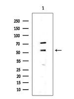 CDK8 Antibody in Western Blot (WB)