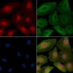 CENPT Antibody in Immunocytochemistry (ICC/IF)