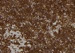 PMS1 Antibody in Immunohistochemistry (Paraffin) (IHC (P))