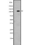 PMS1 Antibody in Western Blot (WB)