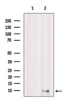 SPINK7 Antibody in Western Blot (WB)