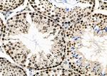 NUFIP2 Antibody in Immunohistochemistry (Paraffin) (IHC (P))