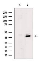 MKX Antibody in Western Blot (WB)