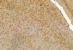 MYOCD Antibody in Immunohistochemistry (Paraffin) (IHC (P))