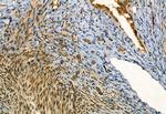 MYOCD Antibody in Immunohistochemistry (Paraffin) (IHC (P))