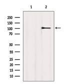 MYOCD Antibody in Western Blot (WB)