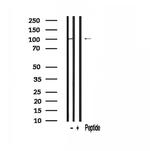 MYOCD Antibody in Western Blot (WB)