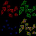 BIN2 Antibody in Immunocytochemistry (ICC/IF)