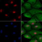 FGF14 Antibody in Immunocytochemistry (ICC/IF)