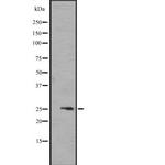 FGF17 Antibody in Western Blot (WB)