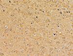 Interferon alpha-4/10/14 Antibody in Immunohistochemistry (Paraffin) (IHC (P))