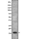 IL1F10 Antibody in Western Blot (WB)