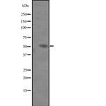 IL-6 Receptor Antibody in Western Blot (WB)