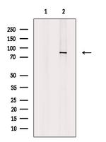 Integrin beta 7 Antibody in Western Blot (WB)