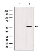 Cytokeratin 36 Antibody in Western Blot (WB)