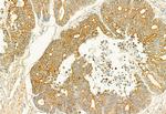 PLCE1 Antibody in Immunohistochemistry (Paraffin) (IHC (P))