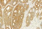 PLCE1 Antibody in Immunohistochemistry (Paraffin) (IHC (P))