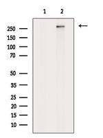 PLCE1 Antibody in Western Blot (WB)