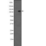 SCP1 Antibody in Western Blot (WB)