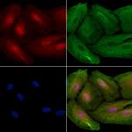 ALKBH4 Antibody in Immunocytochemistry (ICC/IF)