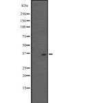 ALKBH4 Antibody in Western Blot (WB)