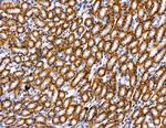 PI3K p55 gamma Antibody in Immunohistochemistry (Paraffin) (IHC (P))