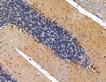 PI3K p55 gamma Antibody in Immunohistochemistry (Paraffin) (IHC (P))